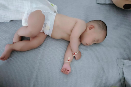 福鼎宝宝黄疸值多少才正常